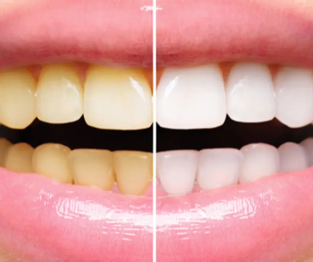 Gula_tander_Gumpearl